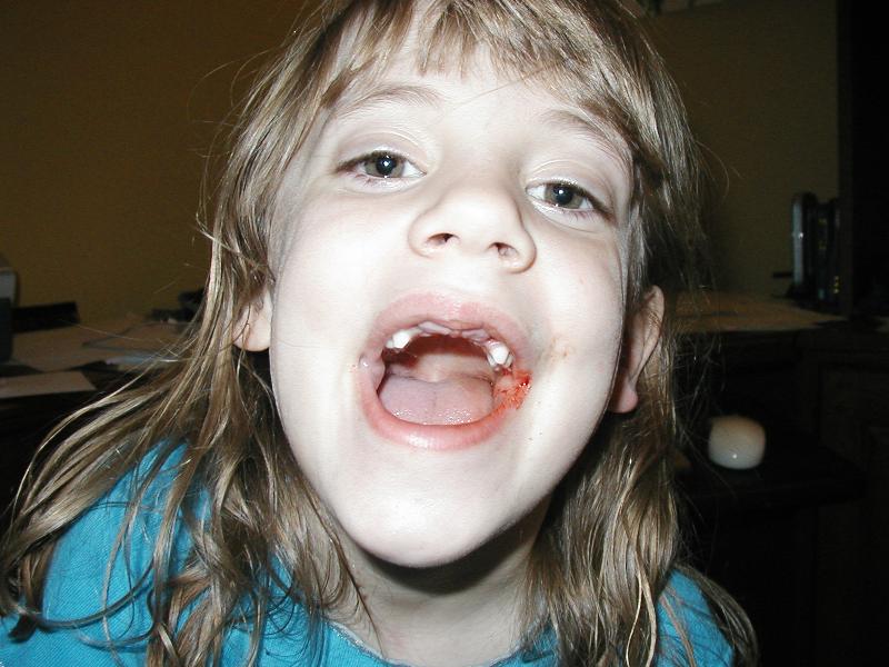 Jordan just lost another tooth!
