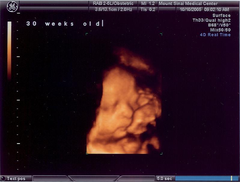 3D Ultrasound of my new neice or nephew!
