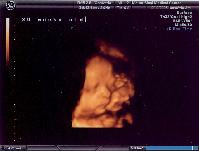 3D Ultrasound of my new neice or nephew!