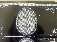 MRI from the top, no contrast 
