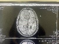 MRI, top view 