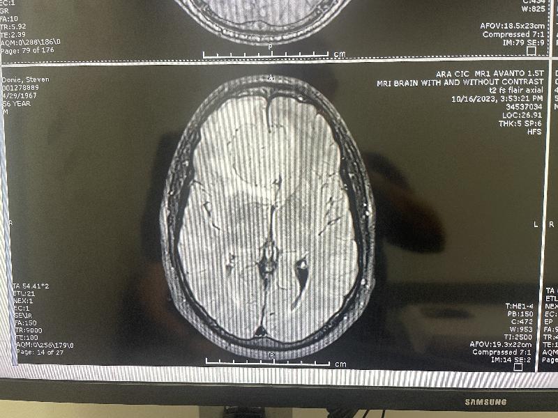 Another MRI top view 