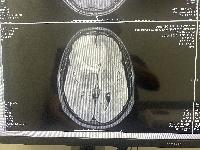 Another MRI top view 
