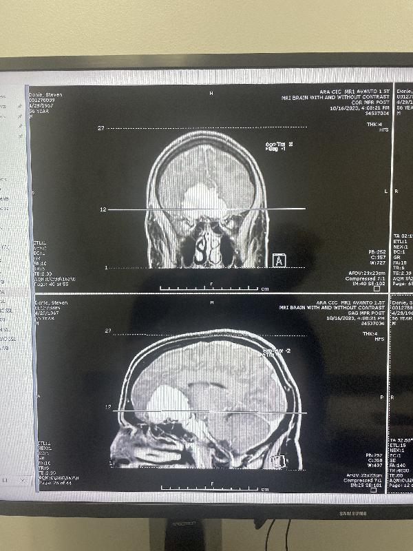 MRI, front and side views 