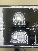 MRI, front and side views 