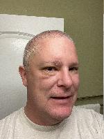 Eye looking much better. November 25, 16 days post op.