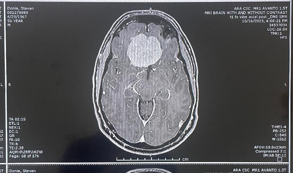 Another clear top view 