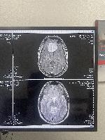 more MRI  (20231020-113459a.jpg)