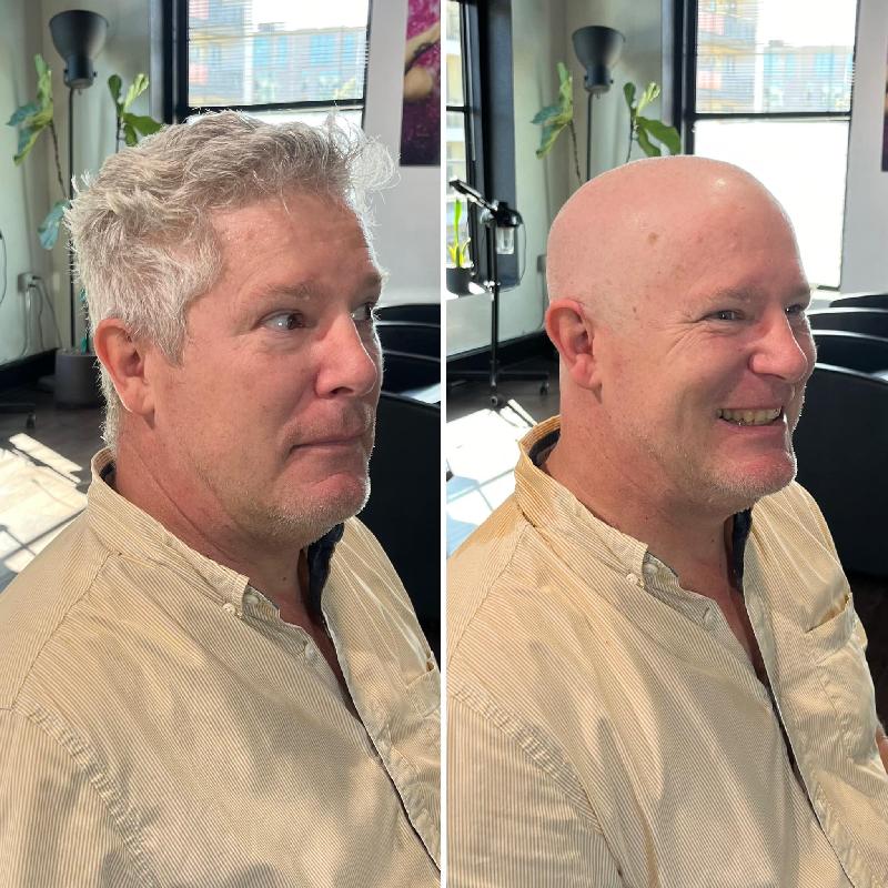 Before and after getting my head shaved. They said I didn't need to, but I wanted to. 
