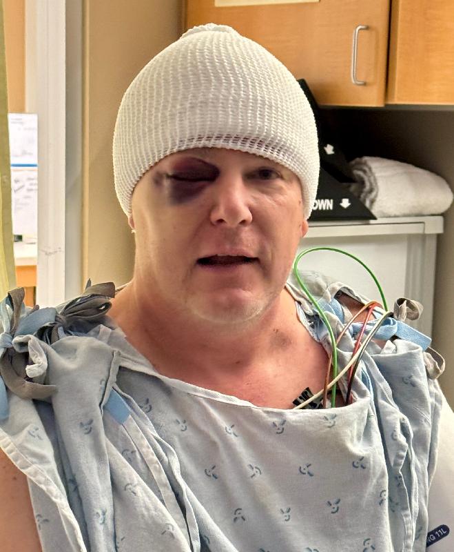 The day after still - lots of wires and stuff still connected