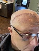 T +5 days  (20231114-103854.jpg)