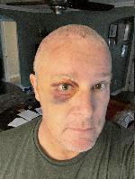 One week later  (20231116-081058.jpg)