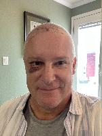 Hair showing some stubble  (20231118-140926.jpg)