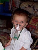 Jada getting nebulized