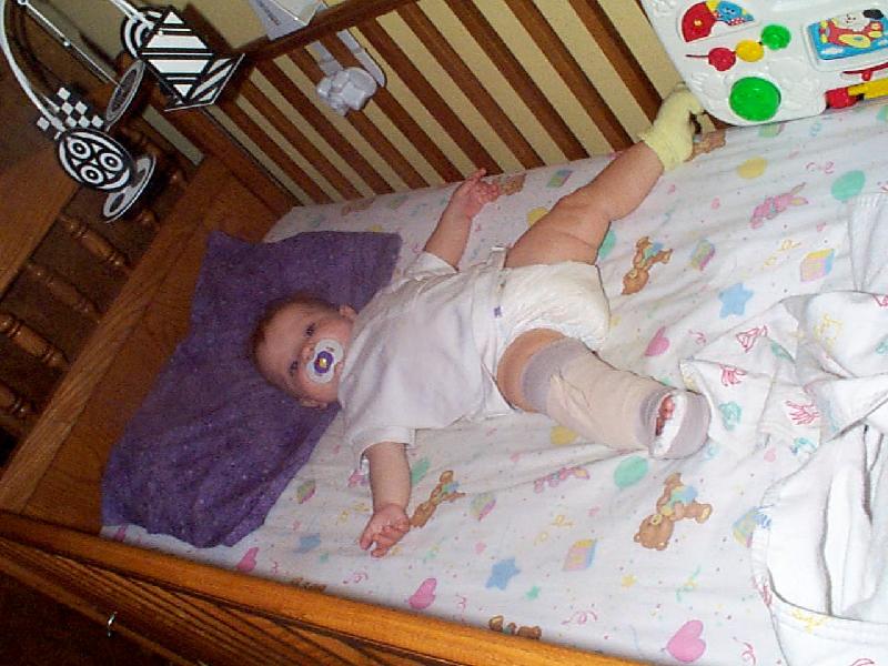 Jada and her splint