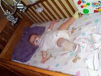 Jada and her splint