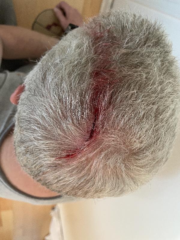 Right after the accident, taken by my client.  