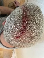 Right after the accident, taken by my client.   (20250922-144722.jpg)